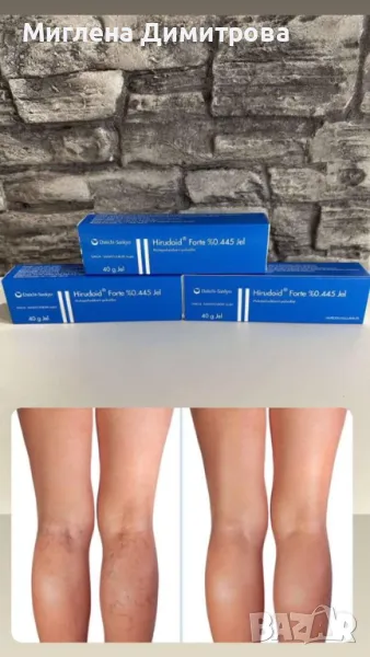 ХИРУДОИД ФОРТЕ КРЕМ - ефективен гел при разширени вени, снимка 1