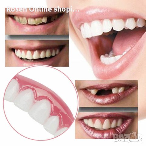 Изкуствени зъби Оверлей( прикриване на развалени зъби), снимка 5 - Други - 43989346
