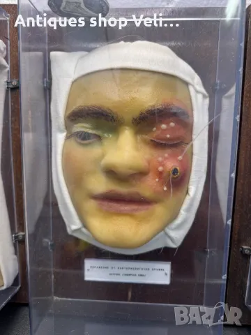 УНИКАЛНО Восъчни Ръчно Изработени Анатомични Мулажи КОЛЕКЦИЯ №69340 , снимка 8 - Антикварни и старинни предмети - 50402170