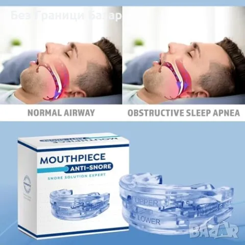 Ново Антихъркащо Устройство 2XL – Комфортна и Ефективна шина за уста, снимка 2 - Други - 49005332