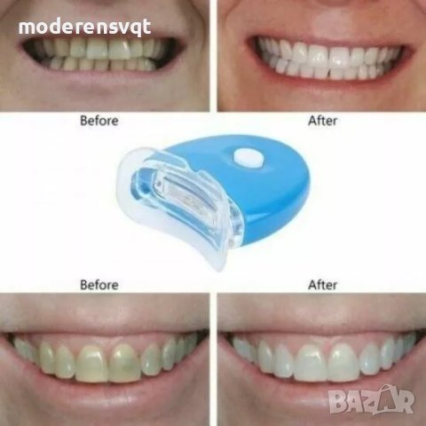 Комплект за избелване на зъби с LED светлина, снимка 6 - Други - 40392231