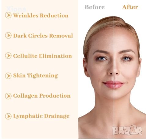 Гуа ша ролер-масажори от неръждаема стомана, снимка 3 - Други - 42852908