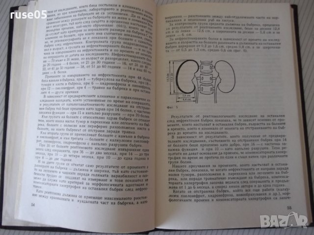 Книга "Болести на единствения бъбрек-Т.Патрашков" - 208 стр., снимка 5 - Специализирана литература - 40456612