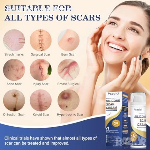 Нов Силиконов крем за белези – хирургия, акне, стрии, изгаряния, операции, снимка 2 - Други - 51107107