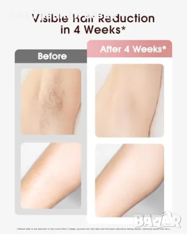 Нов Лазерен уред за епилация с ледено охлаждане – бързи резултати, снимка 8 - Други - 48016272