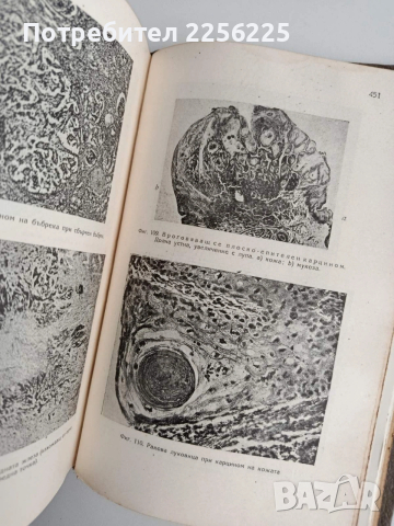 Обща патология и патологическа анатомия, снимка 9 - Специализирана литература - 54183875