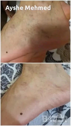 Фитогел за крака „Славитон“, 125 мл, снимка 12 - Козметика за тяло - 55729266