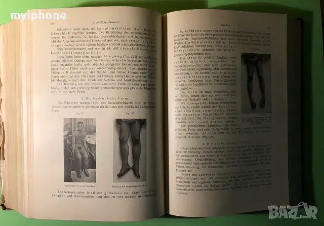 Стара Книга Патология и Лечение на Инфекциозни Болести 2 част 1919 г./1271 страници, снимка 13 - Специализирана литература - 49160295