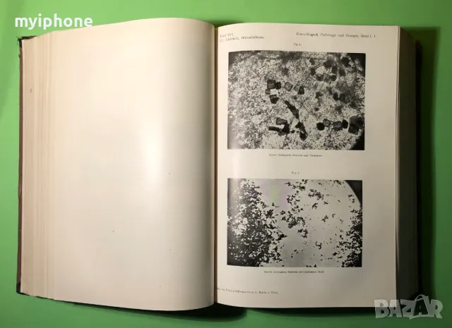 Стара Книга Болести на Обмяната Болести на Жлезите с Вътрешна секреция, снимка 5 - Специализирана литература - 49204935