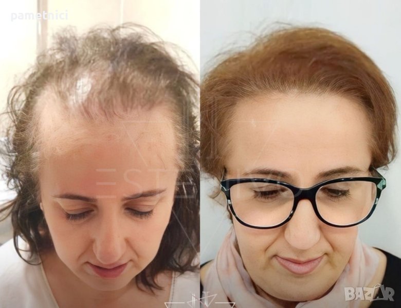 Присаждане на Коса Промоционална цена!, снимка 1