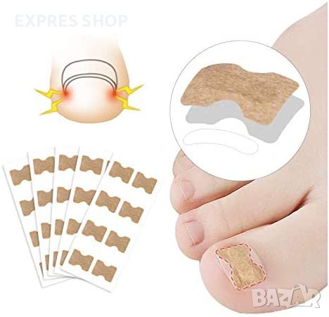 ЛЕПЕНКИ ЗА ВРАСТНАЛ НОКЪТ INGROWN TOENAIL КОМПЛЕКТ ОТ 50 БРОЯ, снимка 1