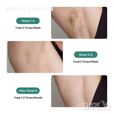 Ulike Air 2 IPL Eпилатор с охлаждаща технология, за тяло и лице., снимка 9 - Козметични уреди - 51938436