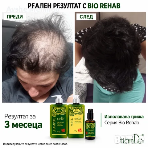 комплек за растеж био рехаб, снимка 4 - Продукти за коса - 56117520