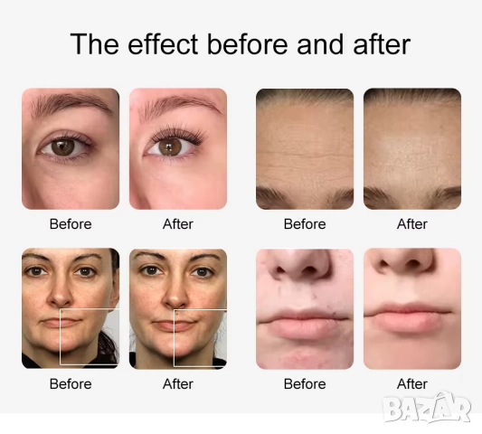 Професионален козметичен апарат за лице Аква Пилинг 10 в 1, снимка 4 - Козметични уреди - 52006226