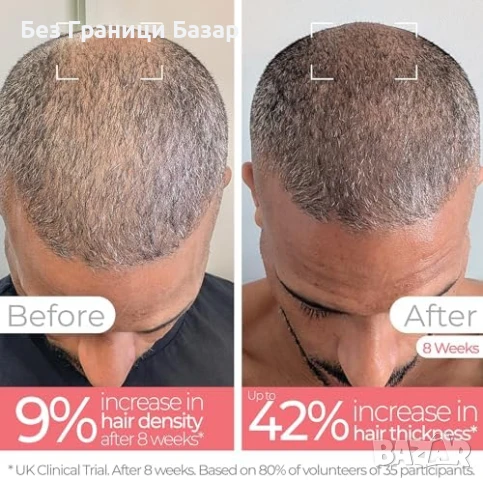 Нова Четка с червена светлина за гъста коса, масаж и терапия жени мъже, снимка 4 - Други - 51131681