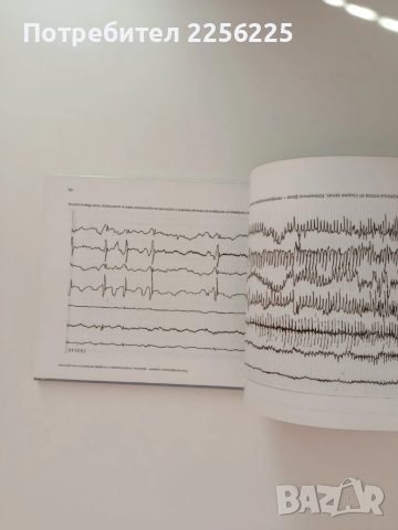 АТЛАС по електроенцефалография при възрастни - от норма към патология, снимка 2 - Специализирана литература - 51792642