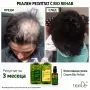 комплек за растеж био рехаб, снимка 4