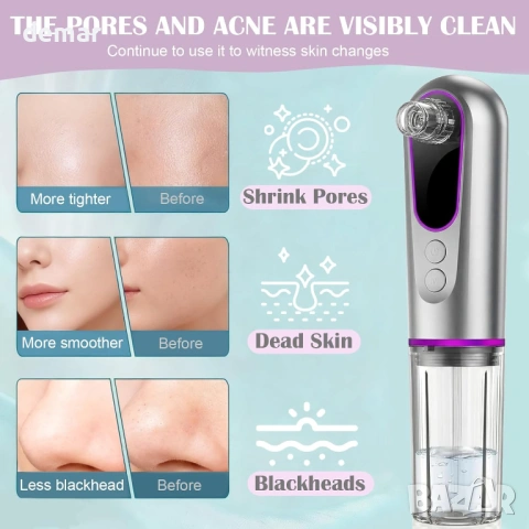 Вакуум за премахване на черни точки, акумулаторен екстрактор на пори с 5 глави, снимка 3 - Други - 54109461