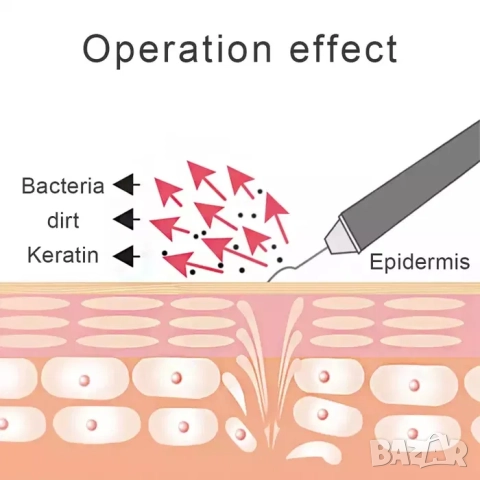Професионален Фриматор ,шпатула за лице за пилинг с ултразвук, ултразвукова, снимка 7 - Козметични уреди - 52162930