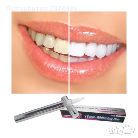 0745 Писалка за избелване на зъби, снимка 11 - Други - 30933817