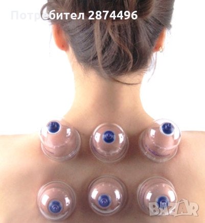 1104 Вендузи за антицелолитен масаж и вакуумна терапия, снимка 5 - Козметика за тяло - 30917075