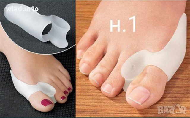 Изпъкнали кокалчета ”hallux valgus”-различни видове, снимка 5 - Ортези и протези - 23726203