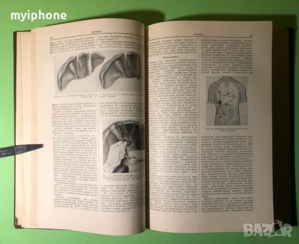Стара Книга Голяма Медицинска Енциклопедия А.Бакулев на Руски, снимка 11 - Специализирана литература - 49309740