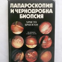 Книга Лапароскопия и чернодробна биопсия - Христо Браилски 1989 г., снимка 1 - Специализирана литература - 29165782