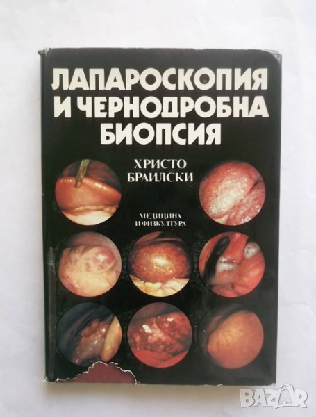 Книга Лапароскопия и чернодробна биопсия - Христо Браилски 1989 г., снимка 1