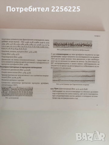 АТЛАС по електроенцефалография при възрастни - от норма към патология, снимка 4 - Специализирана литература - 51792642