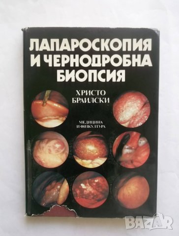 Книга Лапароскопия и чернодробна биопсия - Христо Браилски 1989 г.
