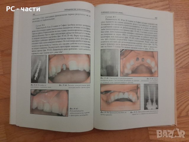 Зъбопротезна имплантология- проф. Николай Попов-1999г., снимка 2 - Специализирана литература - 42554633