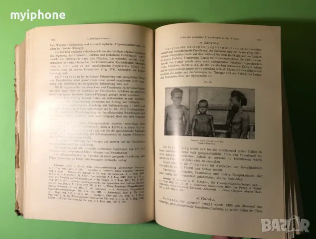 Стара Книга Патология и Лечение на Инфекциозни Болести 2 част 1919 г./1271 страници, снимка 14 - Специализирана литература - 49160295