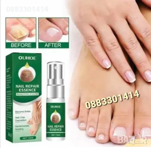 Спрей за нокти Премахва гъбички на ноктите , снимка 7 - Продукти за маникюр - 50094300