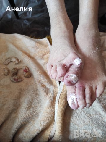 Медицински педикюр по домовете , снимка 18 - Медицински, стоматологични - 24454918