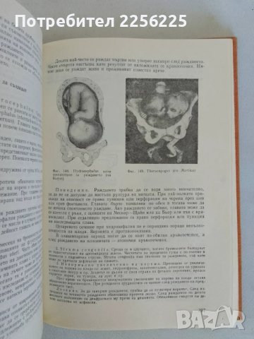 Акушерство , снимка 8 - Специализирана литература - 47491483