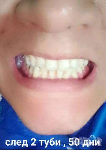 Избелваща паста за зъби за емайл и блясък , снимка 14 - Други - 41901926