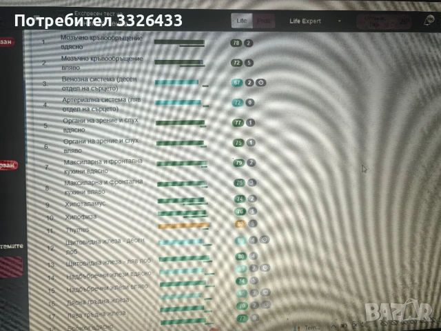 Биорезонанс - диагностика и терапия , снимка 4 - Медицински, стоматологични - 54220027
