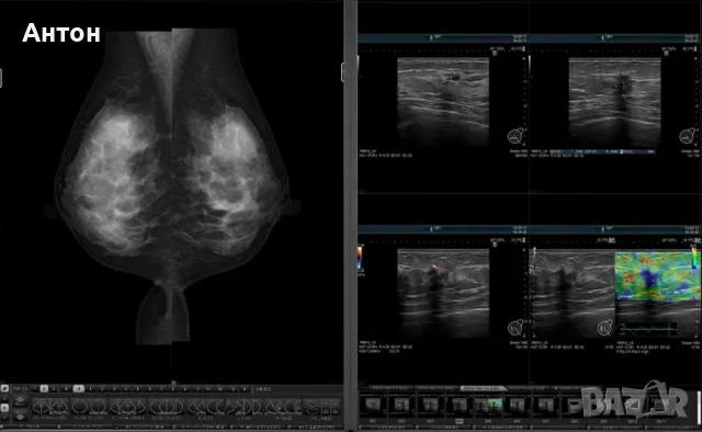Quadro radiforce RTX 4000 EIZO MED-XN92 Medical/за медицинска диагностика, снимка 7 - Видеокарти - 53309394
