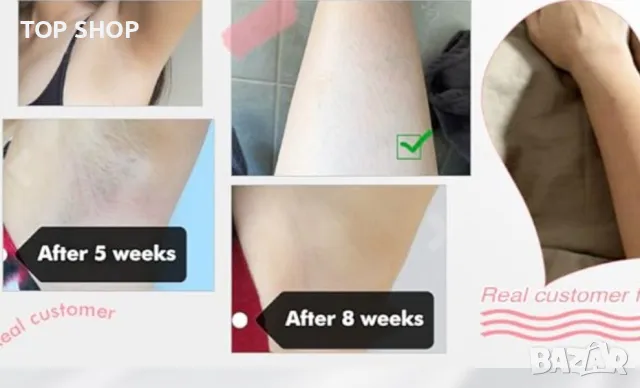 IBORRIA IPL епилатор,999 900 светлинни импулса, снимка 5 - Епилатори - 48934627