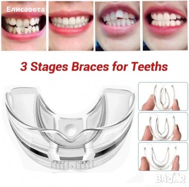 Невидими брекети-шини за зъби ,алайнери, снимка 1