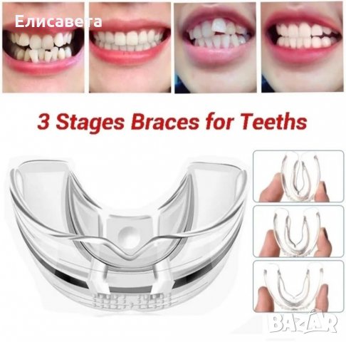 Промо -Невидими брекети-шини за зъби ,алайнери, снимка 1 - Козметика за лице - 31933178