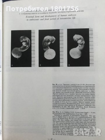 Эмбриология человека Атлас - Л. И. Фалин, снимка 6 - Специализирана литература - 35205923