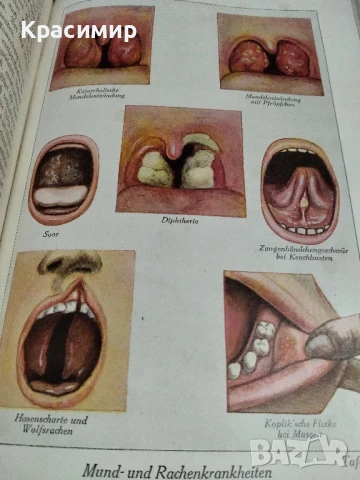 Семеен Лекар .1926 г.д-р мед.Бела Мюлер., снимка 8 - Антикварни и старинни предмети - 51139029