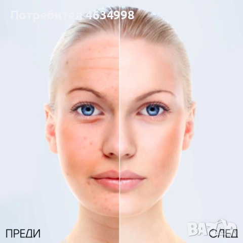 Ултразвуков масажор за лице - TV224, снимка 4 - Масажори - 52204634