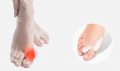 Силиконов разделител за кокалче за крака, снимка 2