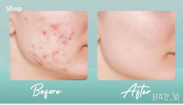 🪞 Регенериращ крем , снимка 8 - Козметика за лице - 53216241