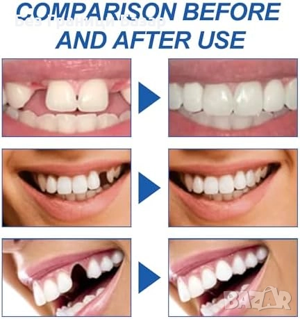 Нов Временен комплект за поправка на зъби, пломби и липсващи зъби, снимка 6 - Други - 51608959