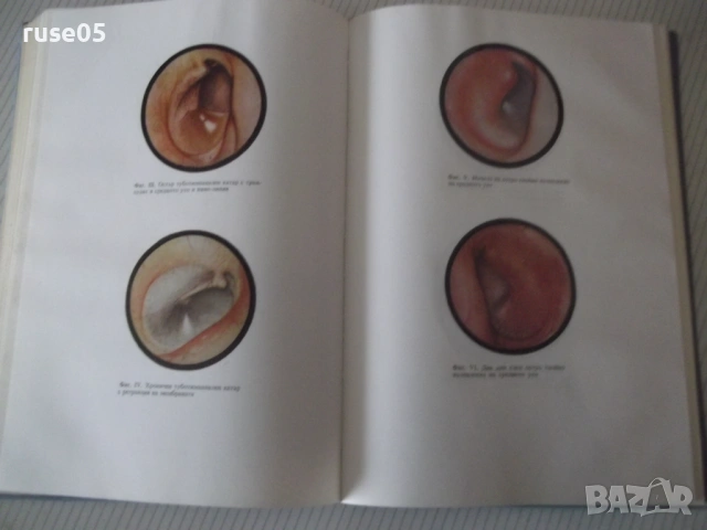 Книга "Ушни носни и гърлени болести - Вл. Павлов" - 296 стр., снимка 6 - Учебници, учебни тетрадки - 53218944