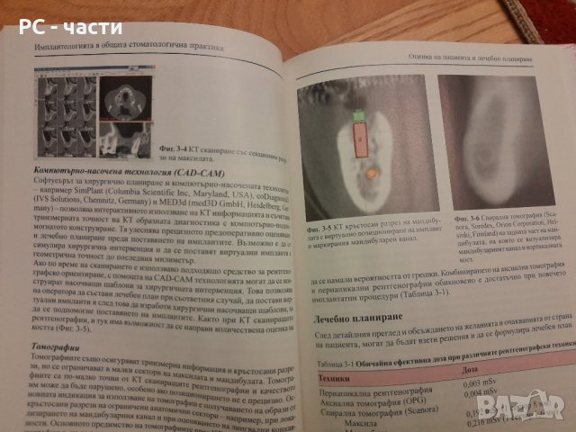 Имплантологията в общата стоматологична практика- Сиърсън, Гауф, Хемингс - 2005г., 102 стр., снимка 9 - Специализирана литература - 42554758